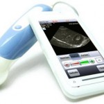 Портативный ультразвуковой сканер MobiUS, работающий в паре со смартфонами